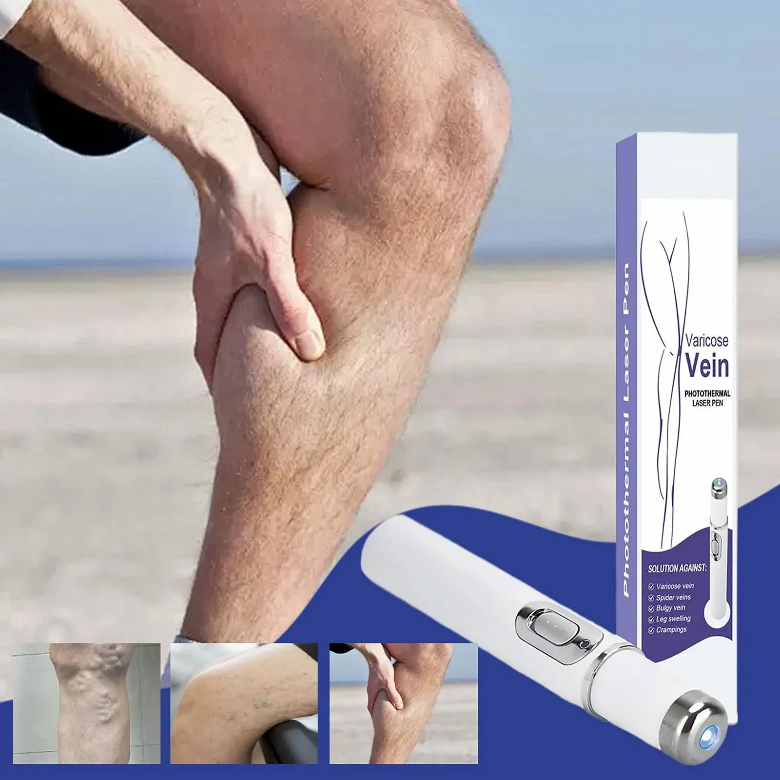 Прибор для удаления сосудистых звездочек Spider Vein Removal Pen портативный, фото №3