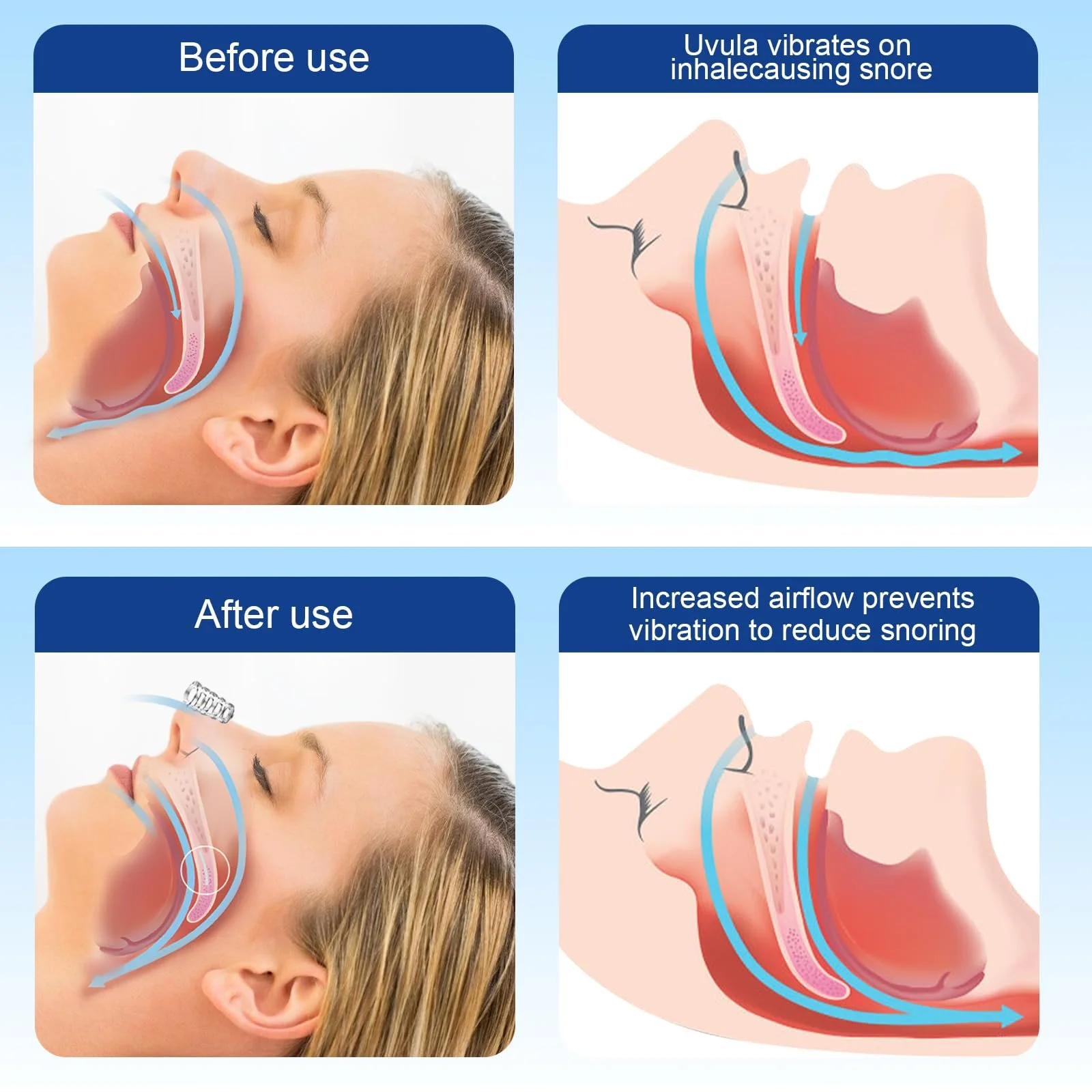 Антихрап пристрій 8 шт Багаторазовий розширювач, фото №2