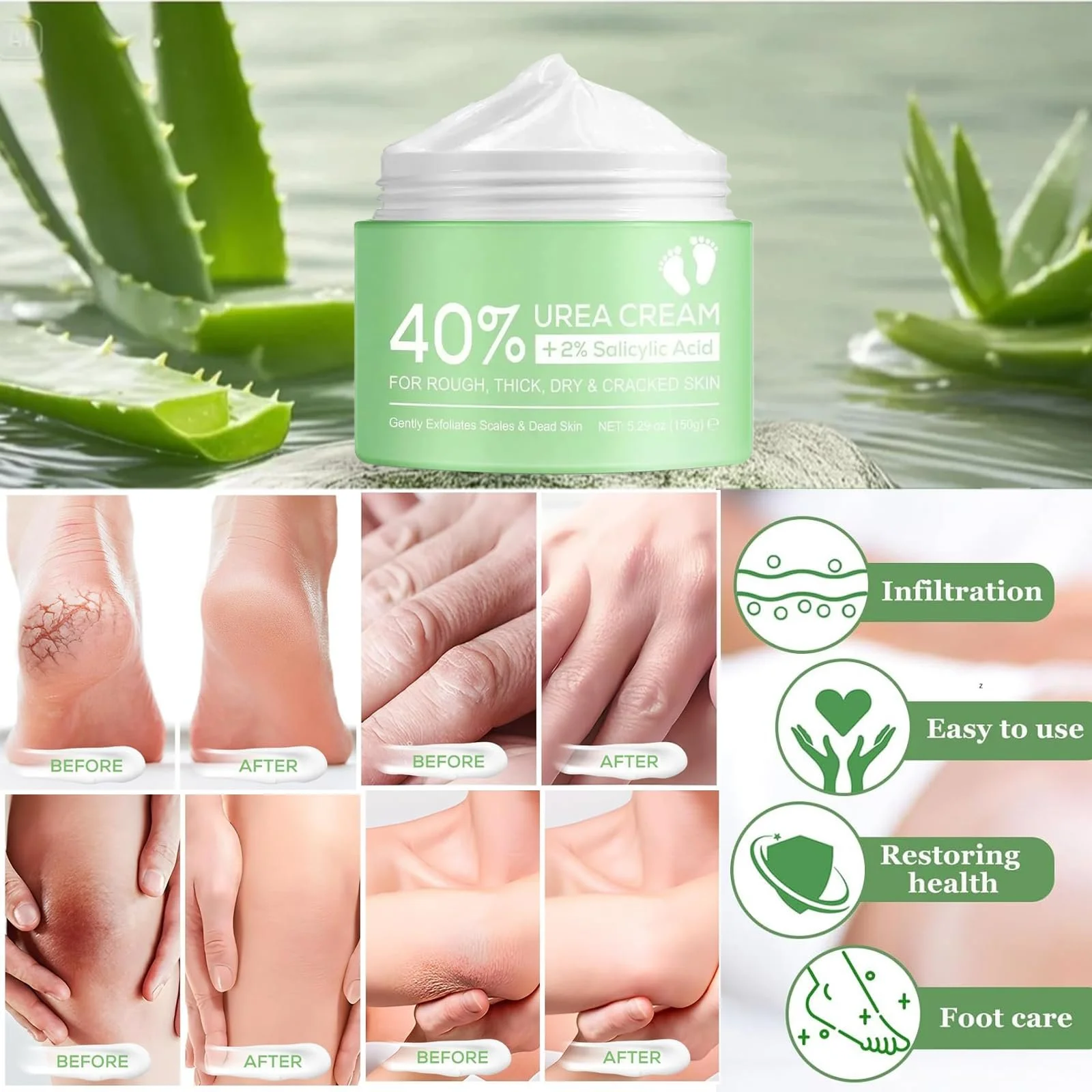 Крем для ног Callus Remover с мочевиной 40%, гиалуроновой кислотой и чайным деревом, 150 мл, фото №4