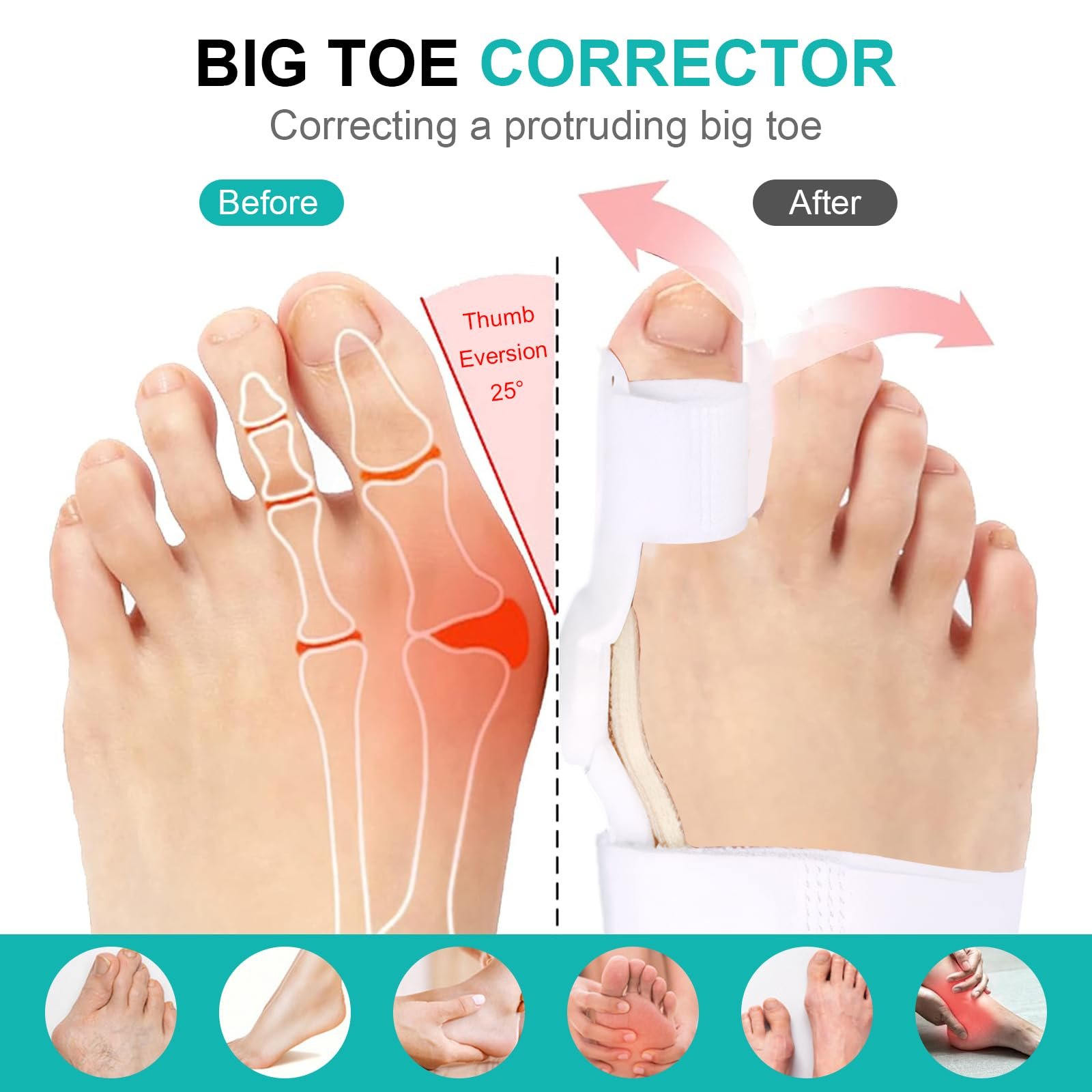 Шина для корекції Hallux Valgus (2 шт.) Регульований роздільник для пальців Синій, фото №3