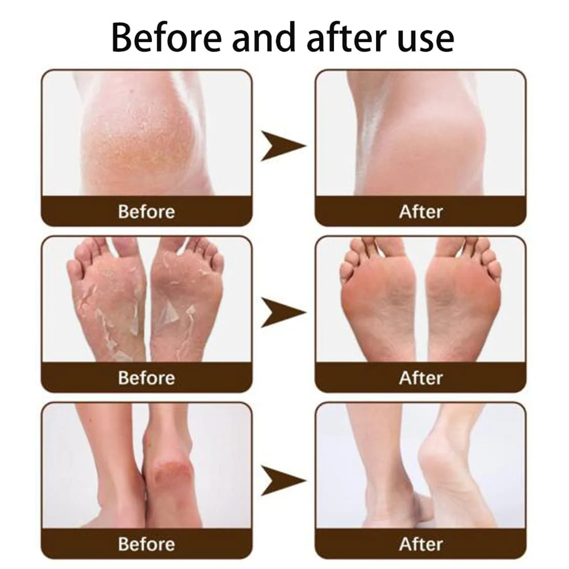 Крем для ног и рук зимний для потрескавшейся кожи увлажняющий портативный для взрослых и детей, фото №6