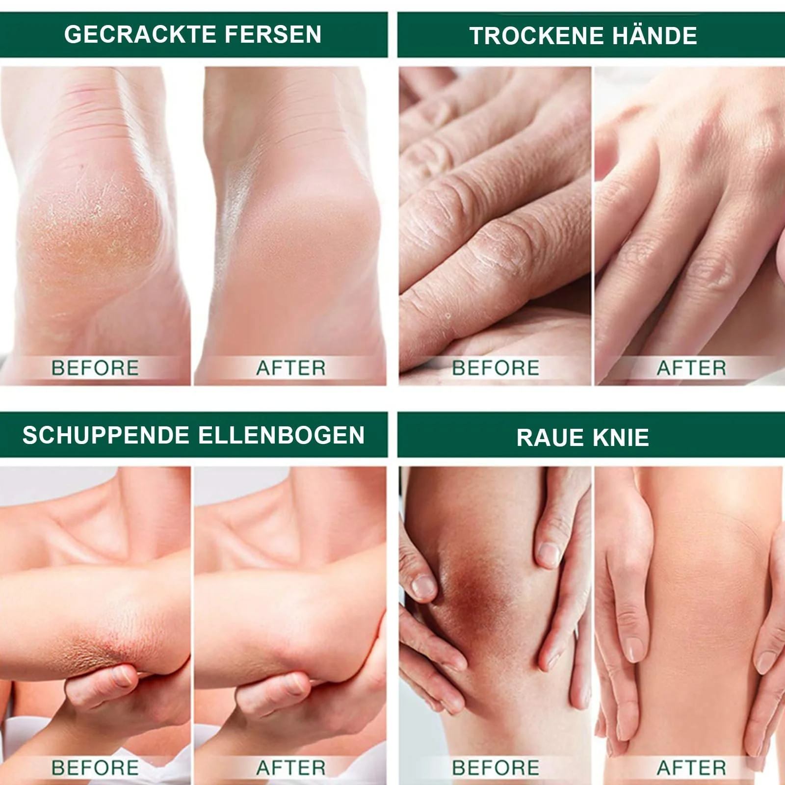 Крем для ног Urea Cream 42% с салициловой кислотой 2% (синий), фото №6