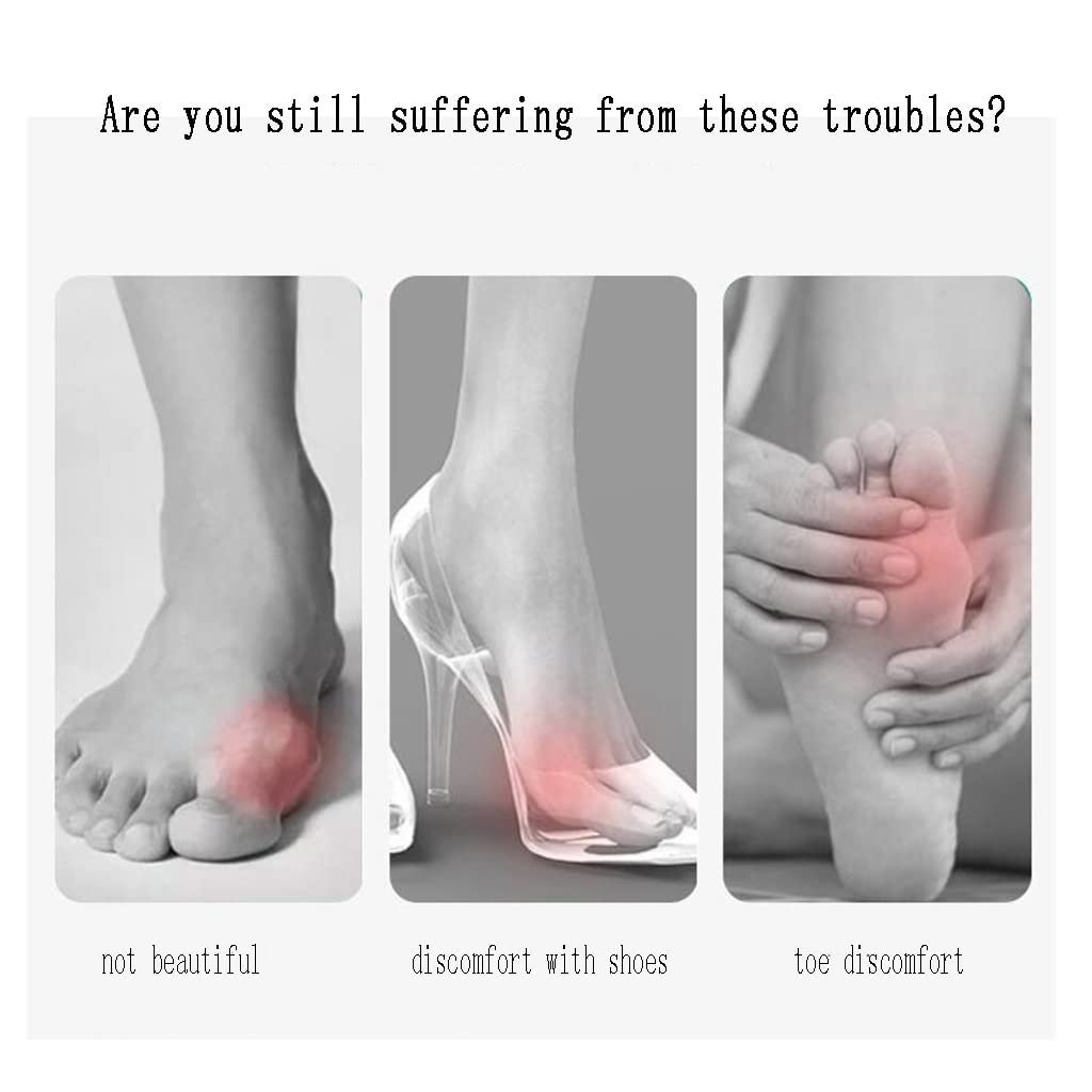 Коректор для великого пальця стопи CAZARU,  Hallux Valgus, роздільник, фото №5