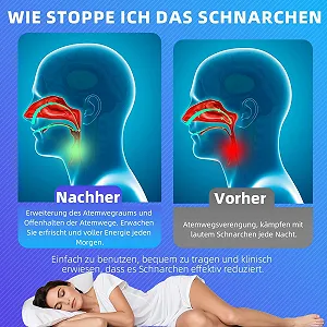 Засіб від хропіння Багатофункціональна шина synthetic.ua - Фото 1