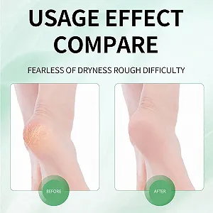 Лосьйон для видалення мозолів Lotion Anti Callosités для догляду за ногами synthetic.ua - Фото 1