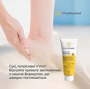Відновлювальний крем для ніг CicaManuka з медом манука IAA15+ 75 мл ціна на synthetic.ua - Фото 1 Відновлювальний крем для ніг CicaManuka з медом манука IAA15+ 75 мл synthetic.ua - Фото 1