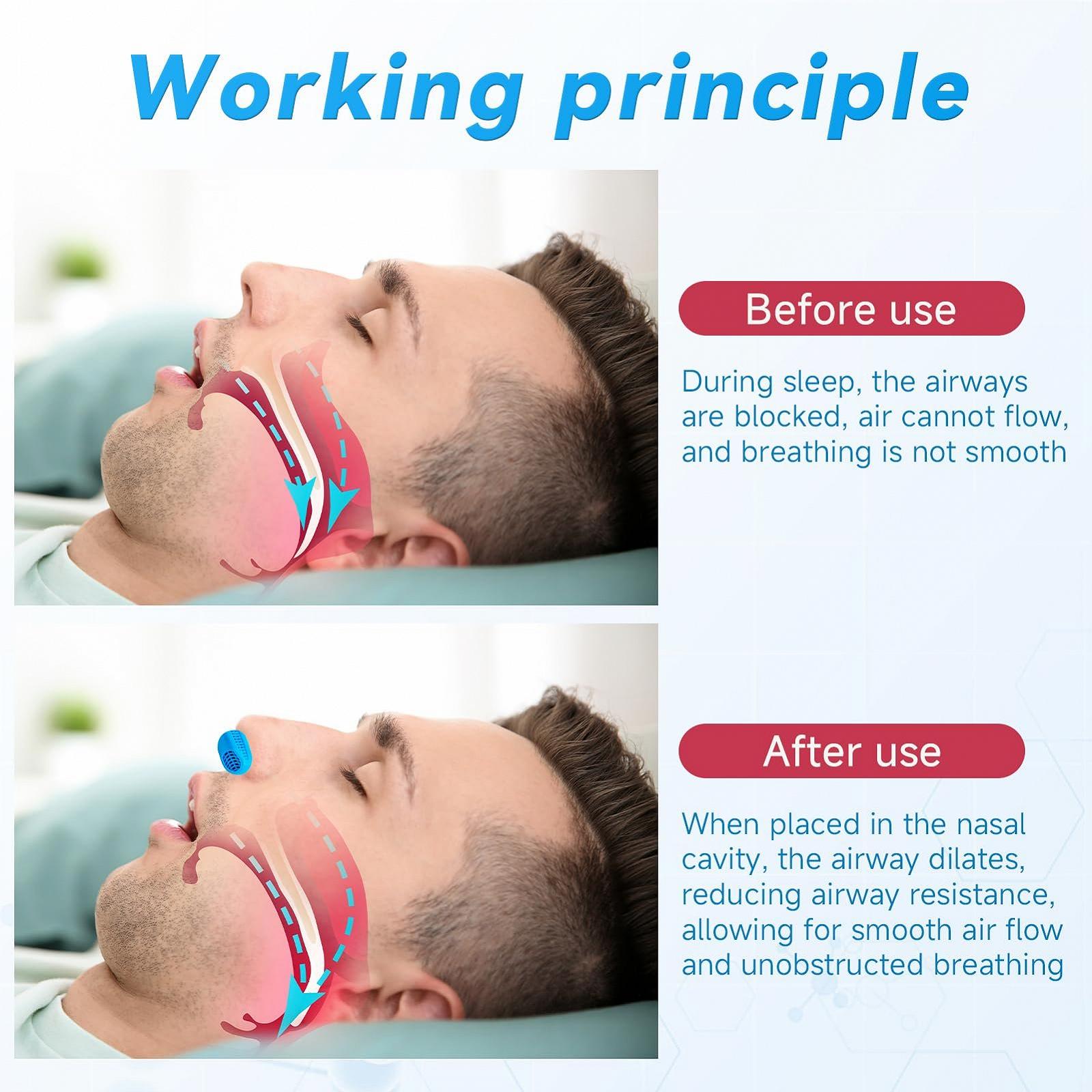 Ремінець для підборіддя проти хропіння Стоппер, фото №5