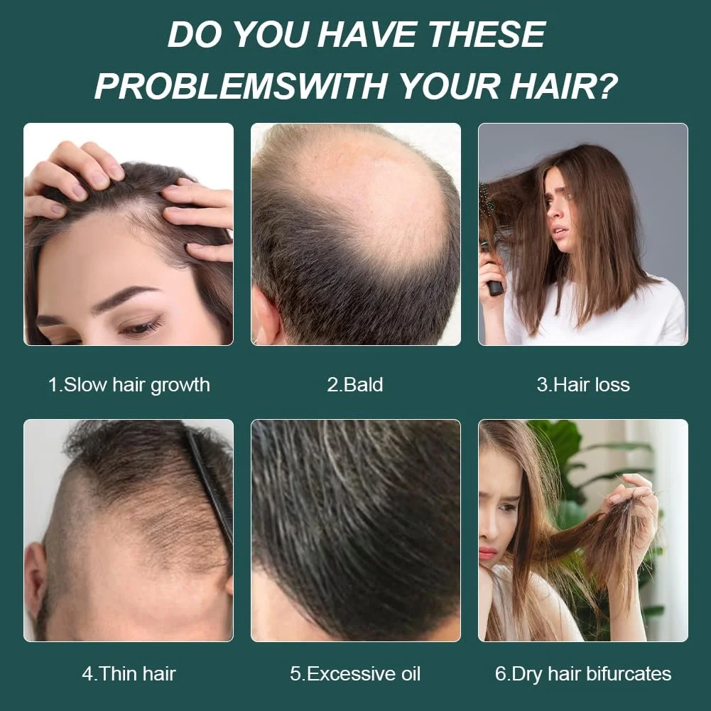 Сироватка для росту волосся, Засіб для росту волосся для жінок і чоловіків, фото №7