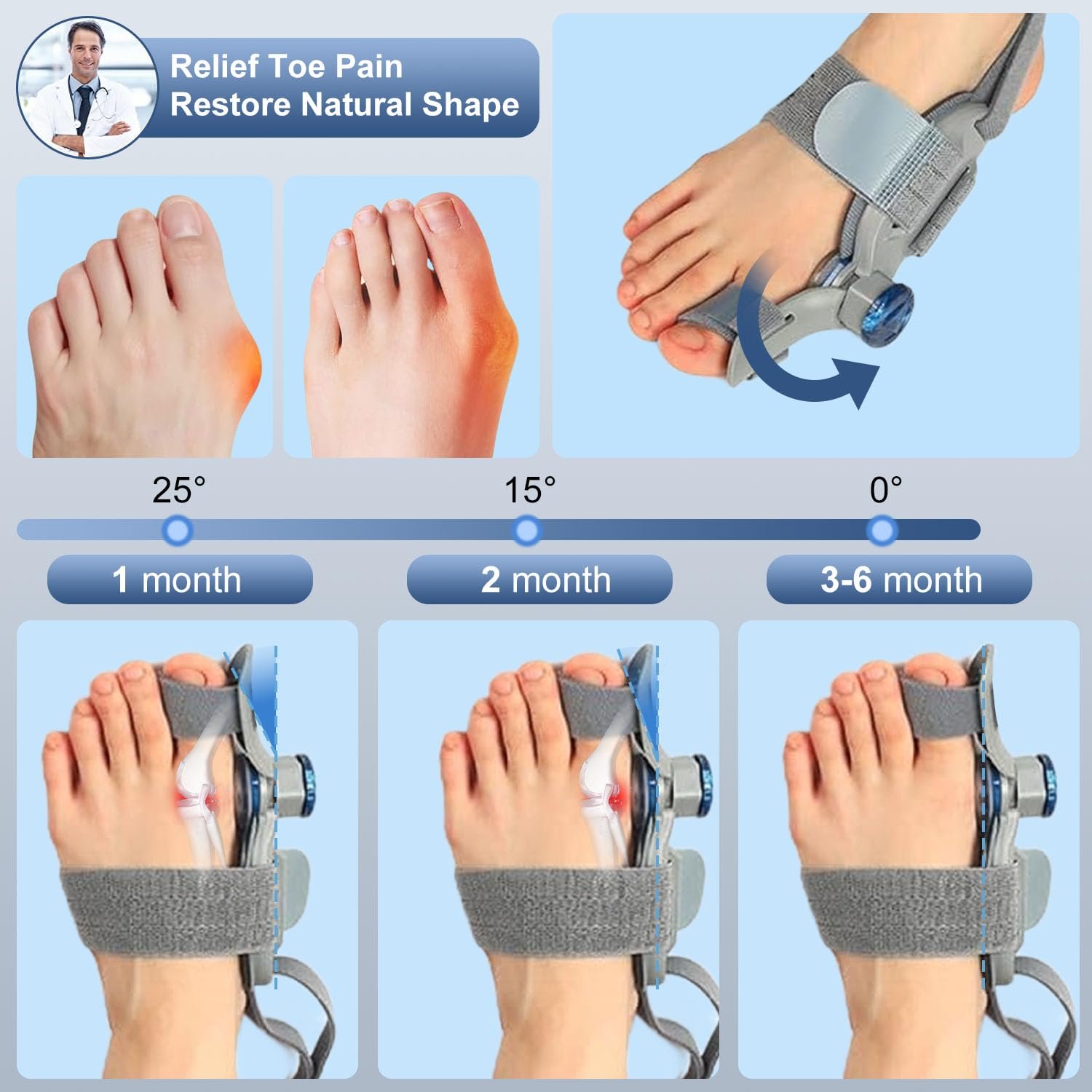 Шина для великого пальця стопи Beseloa, Регульована ортопедична кнопка для лівої/правої ноги, фото №5