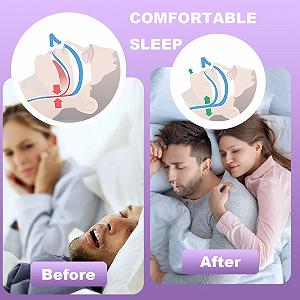 Пластыри для сна в рот, 120 шт. для рта премиум-качества для сна, Помогает против храпа synthetic.ua - Фото 1