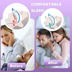 Пластирі для сну на рот, 120 шт. для рота преміум-якості для сну, Допомагає проти хропіння synthetic.ua - Фото 1