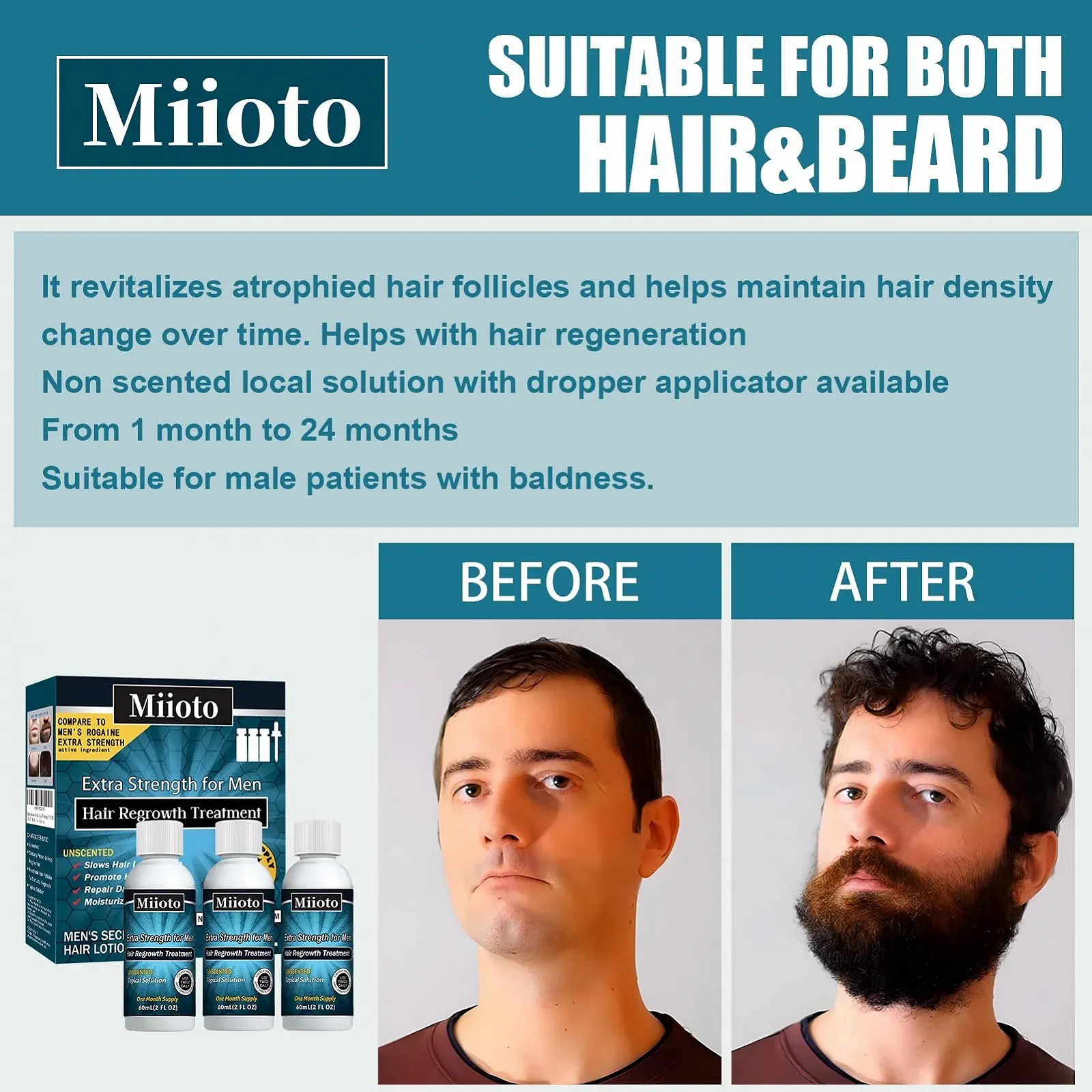 Сироватка для росту волосся Miioto, 180 мл, засіб для росту волосся для чоловіків, фото №2