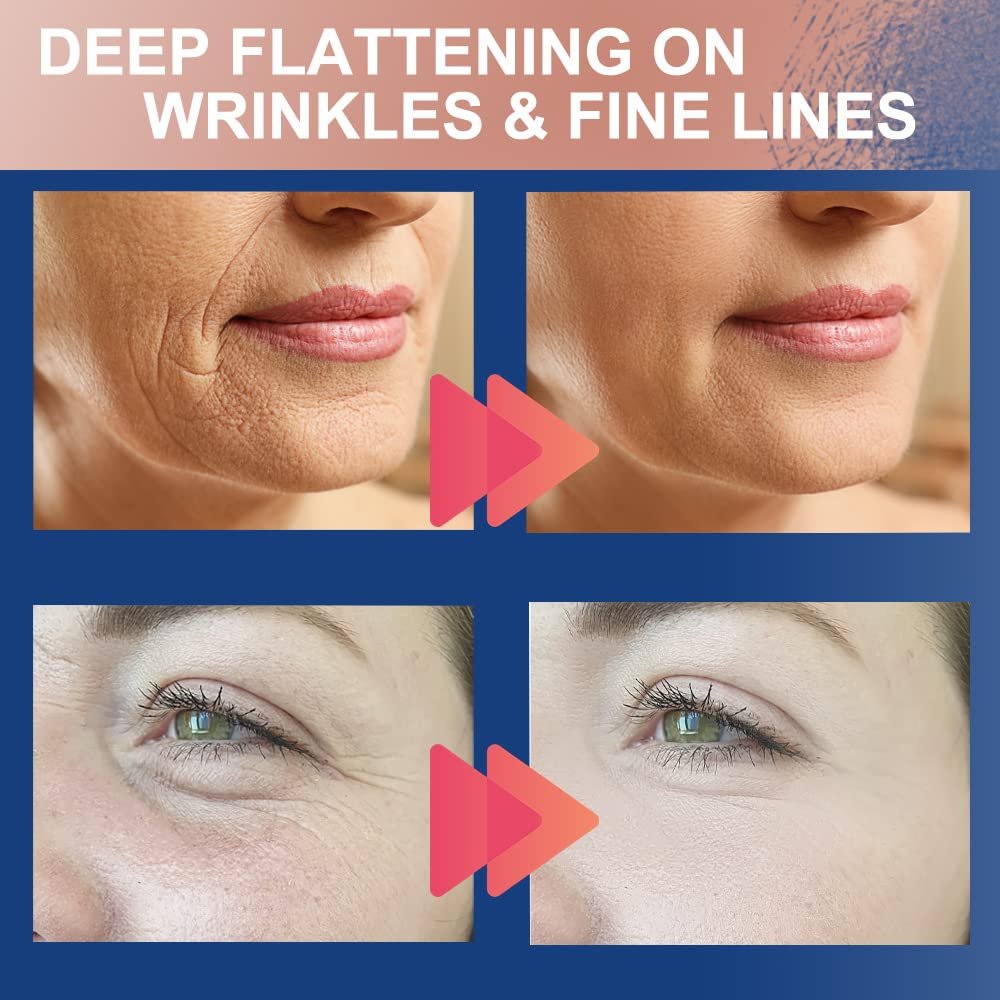 Лента для подтяжки лица Akissos 2 рулона 2.5 см x 5 м, фото №5