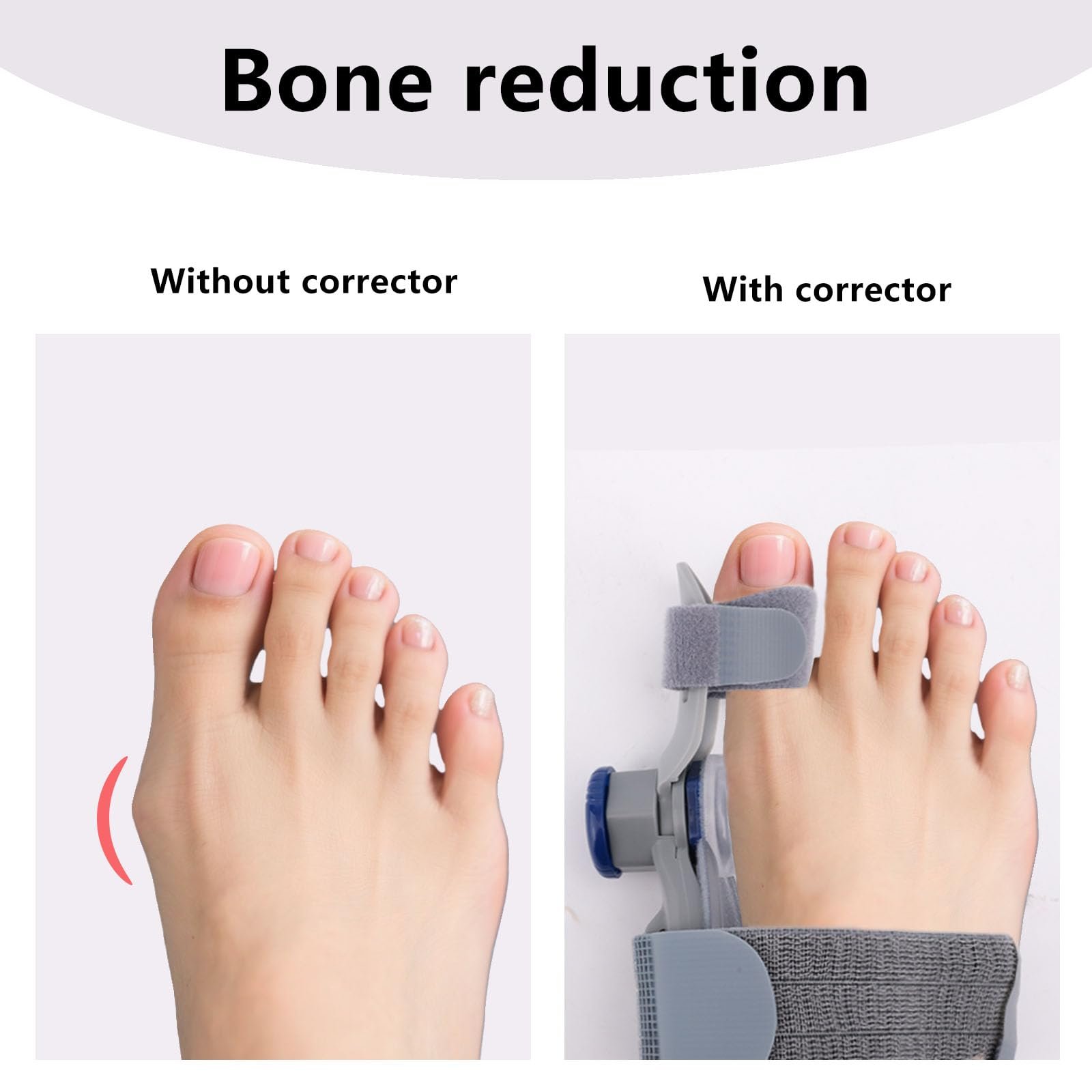 Коректор великого пальця стопи Регульований, фото №7