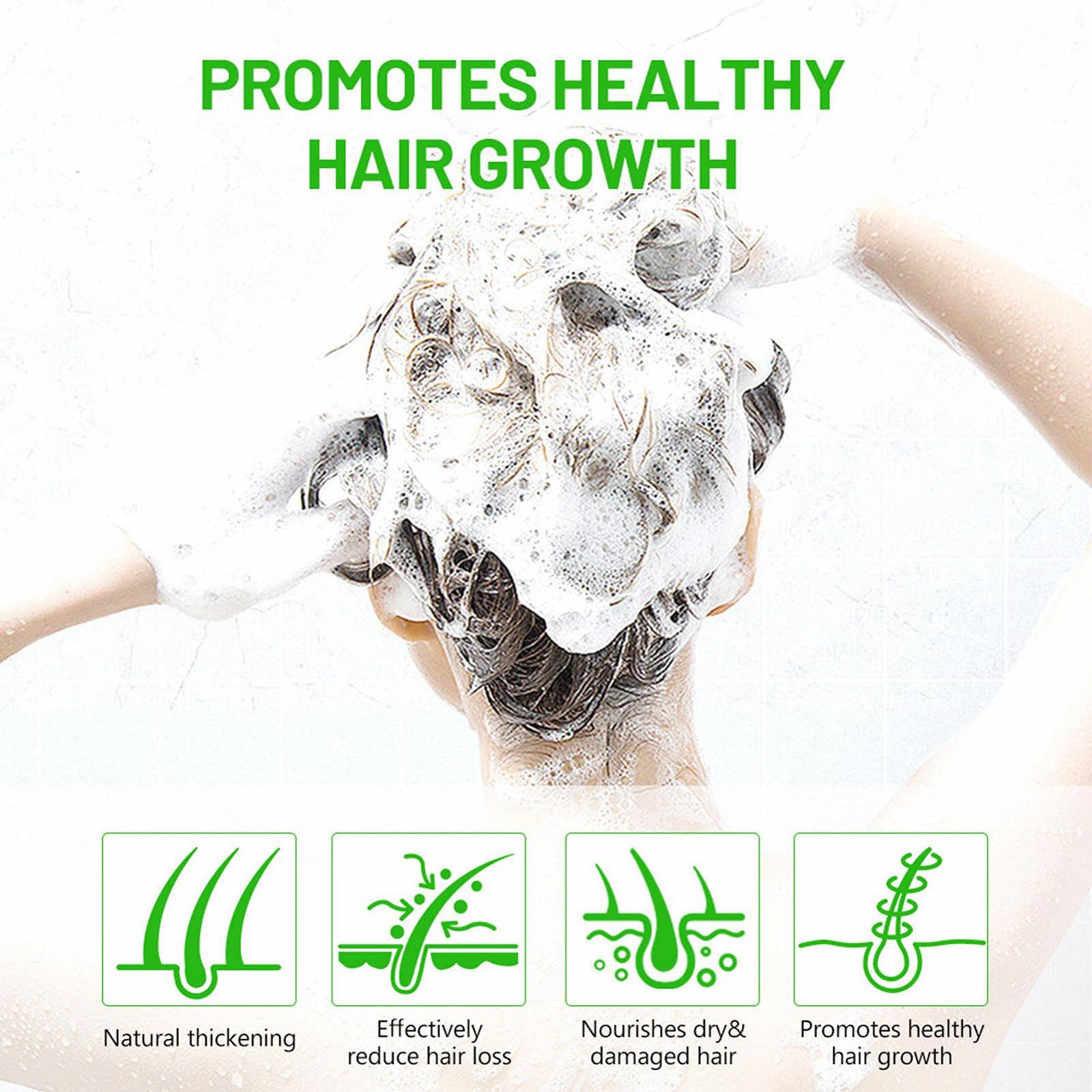 Шампунь в бруску Anloximt для росту волосся Живильний Відновлювальний Антизудний для жінок, фото №4