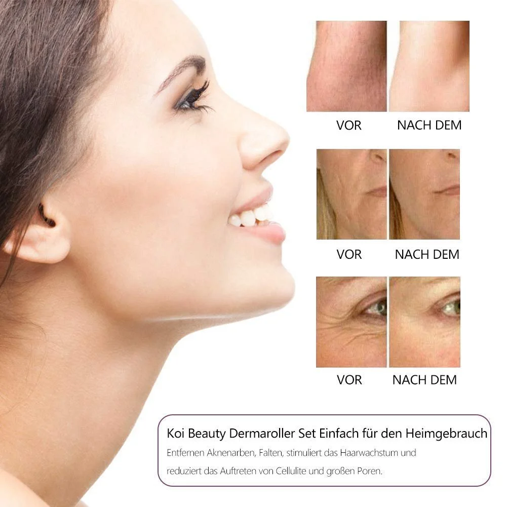 Derma Roller KOI BEAUTY 6 в 1 Microneedling, фото №3