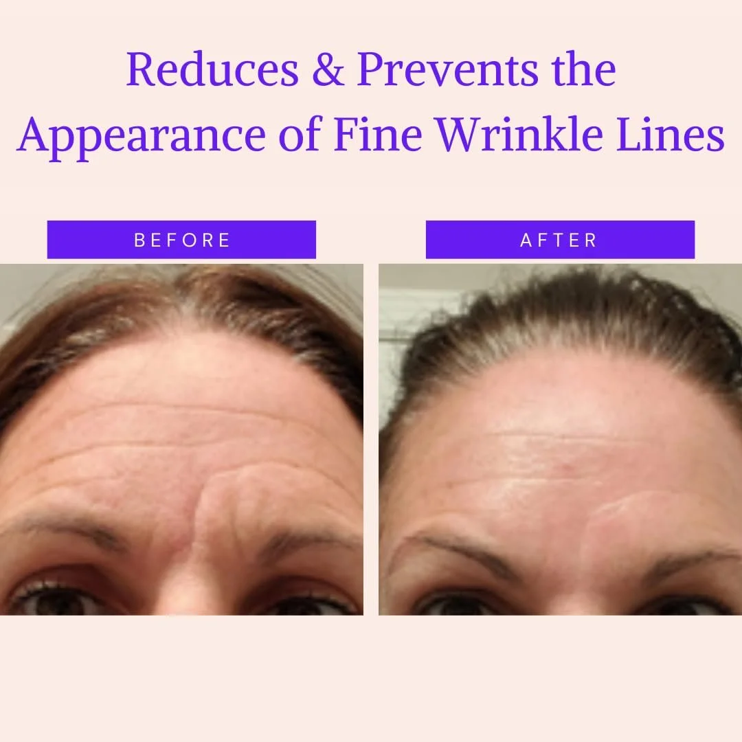 Пластирі для обличчя проти старіння 165 шт.: Пластирі для лоба, Зморшки навколо очей, фото №2 Пластирі для обличчя проти старіння 165 шт.: Пластирі для лоба, Зморшки навколо очей, фото №2