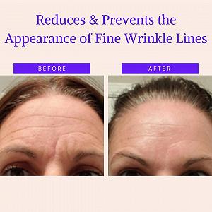 Пластирі для обличчя проти старіння 165 шт.: Пластирі для лоба, Зморшки навколо очей synthetic.ua - Фото 1