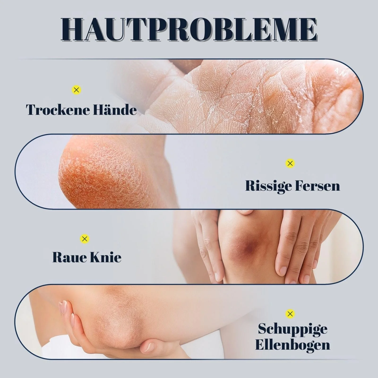 Крем для ног и тела Urea 40% & 2% Salic интенсивный от мозолей 100 г, фото №3