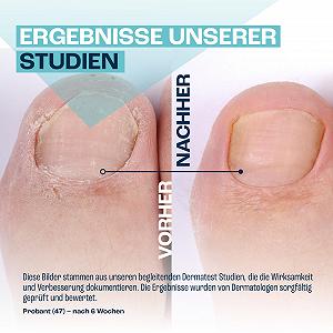 Гель для ногтей GOaktiv Питательный 3 x 10 мл synthetic.ua - Фото 1