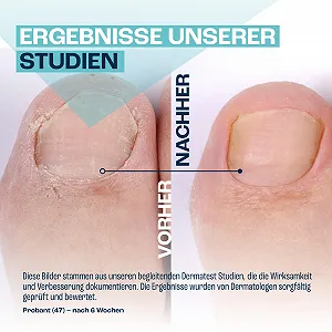 Гель для ногтей GOaktiv Питательный 3 x 10 мл synthetic.ua - Фото 1