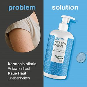 Гель для душа Rub Skin для кожи с фолликулярным кератозом и грубой кожи с салициловой кислотой, ниацинамидом, цинком PCA и глицерином synthetic.ua - Фото 1