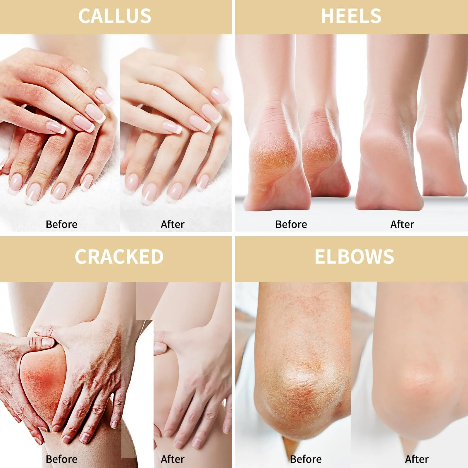 Крем для ног Urea 50% с овсом и 2% салициловой кислотой 150 г, фото №5