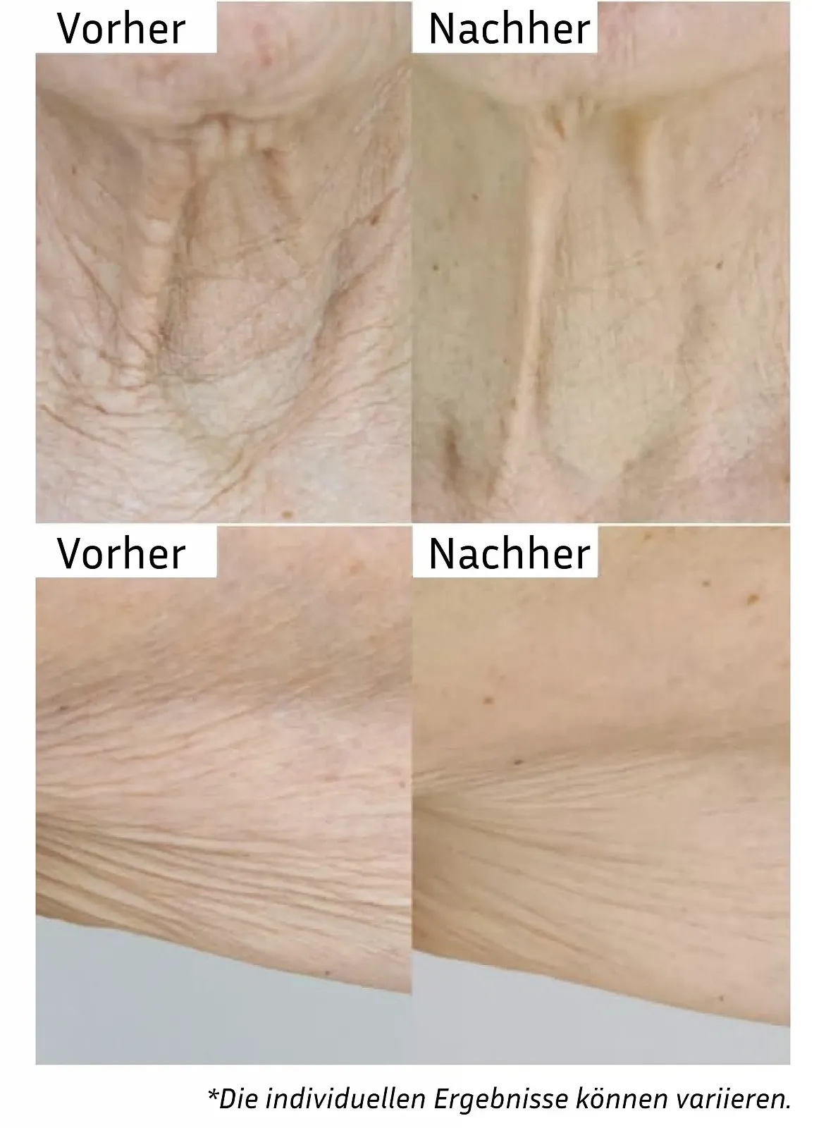 Бальзам для тіла City Beauty InvisiCrepe - Зміцнюючий та підтягуючий лосьйон для більш гладкого та пружного вигляду, фото №2