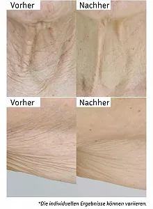 Бальзам для тіла City Beauty InvisiCrepe - Зміцнюючий та підтягуючий лосьйон для більш гладкого та пружного вигляду synthetic.ua - Фото 1