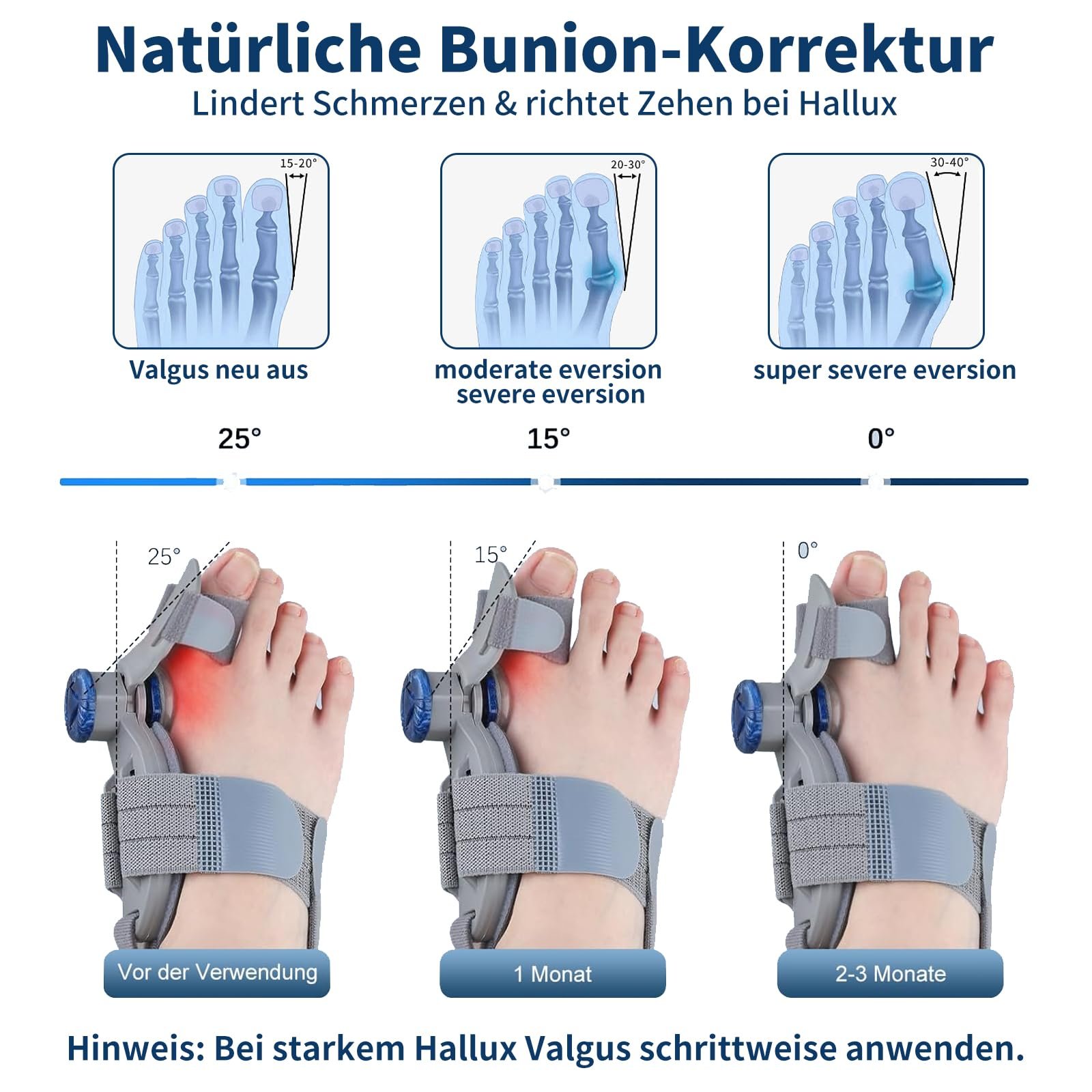 Шина Hallux Valgus Зручна корекція буньйону з регульованою на 180 градусів шиною та силіконовою подушечкою для дня/ночі (Унісекс, Сірий), фото №2