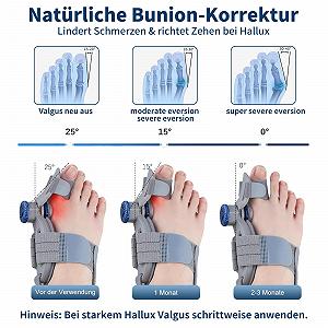 Шина Hallux Valgus Зручна корекція буньйону з регульованою на 180 градусів шиною та силіконовою подушечкою для дня/ночі (Унісекс, Сірий) synthetic.ua - Фото 1