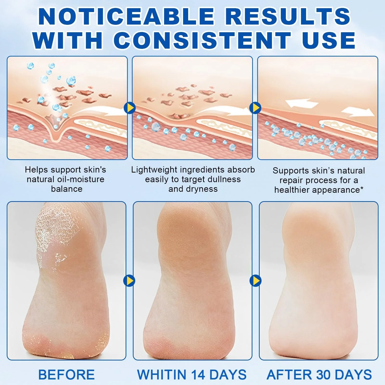 Крем для ног Urea 60% увлажняющий против трещин 2 шт, фото №4