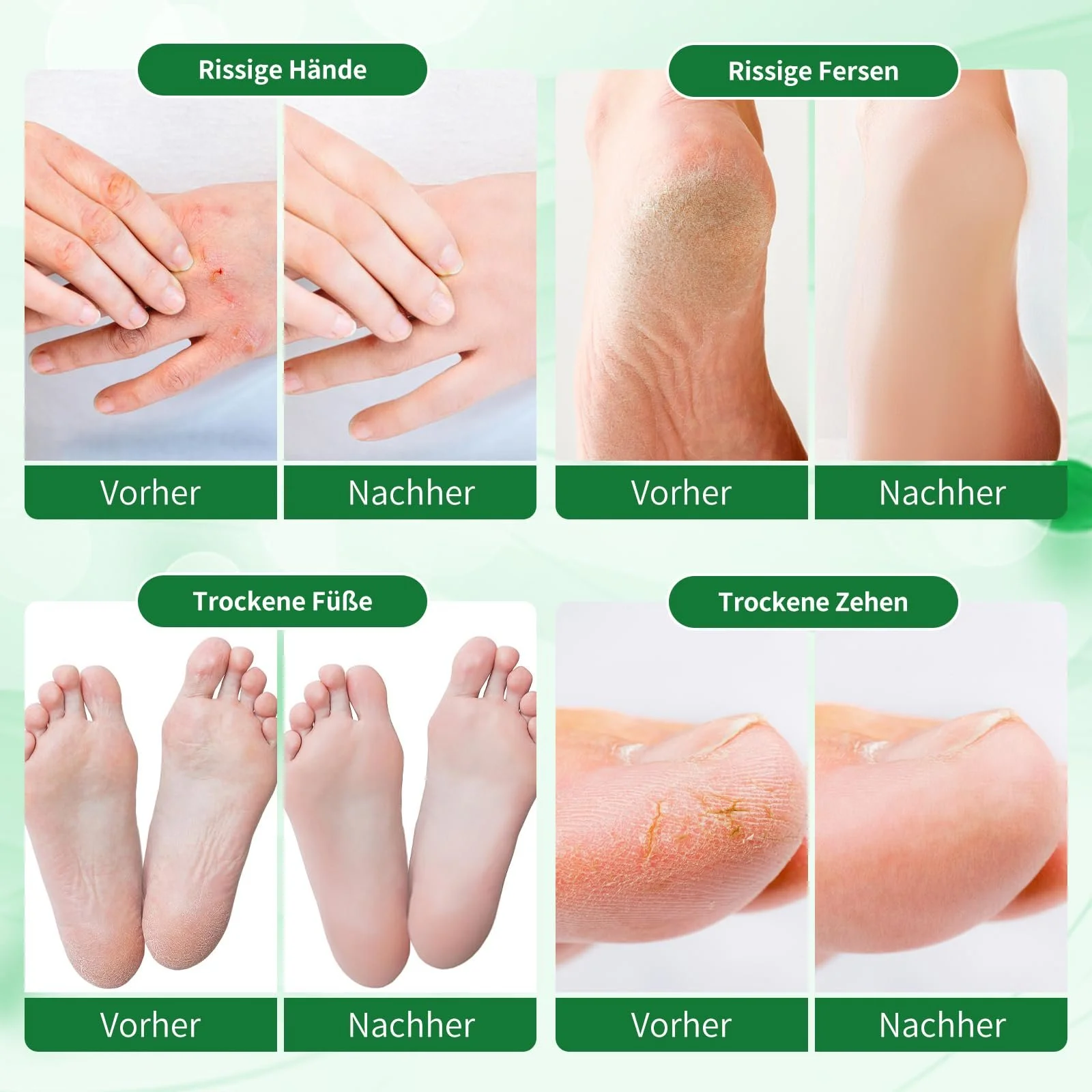 Крем для ног Foot Cream для сухой и потрескавшейся кожи, с глицерином, витамином E и мятой, 250 мл, фото №6