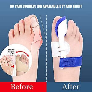 Коректор великого пальця стопи Ортопедичні, зручна ходьба (2 пари) synthetic.ua - Фото 1