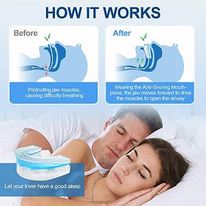 Устройство против храпа Anti-Snoring, противохрап, шина (средний) synthetic.ua - Фото 1
