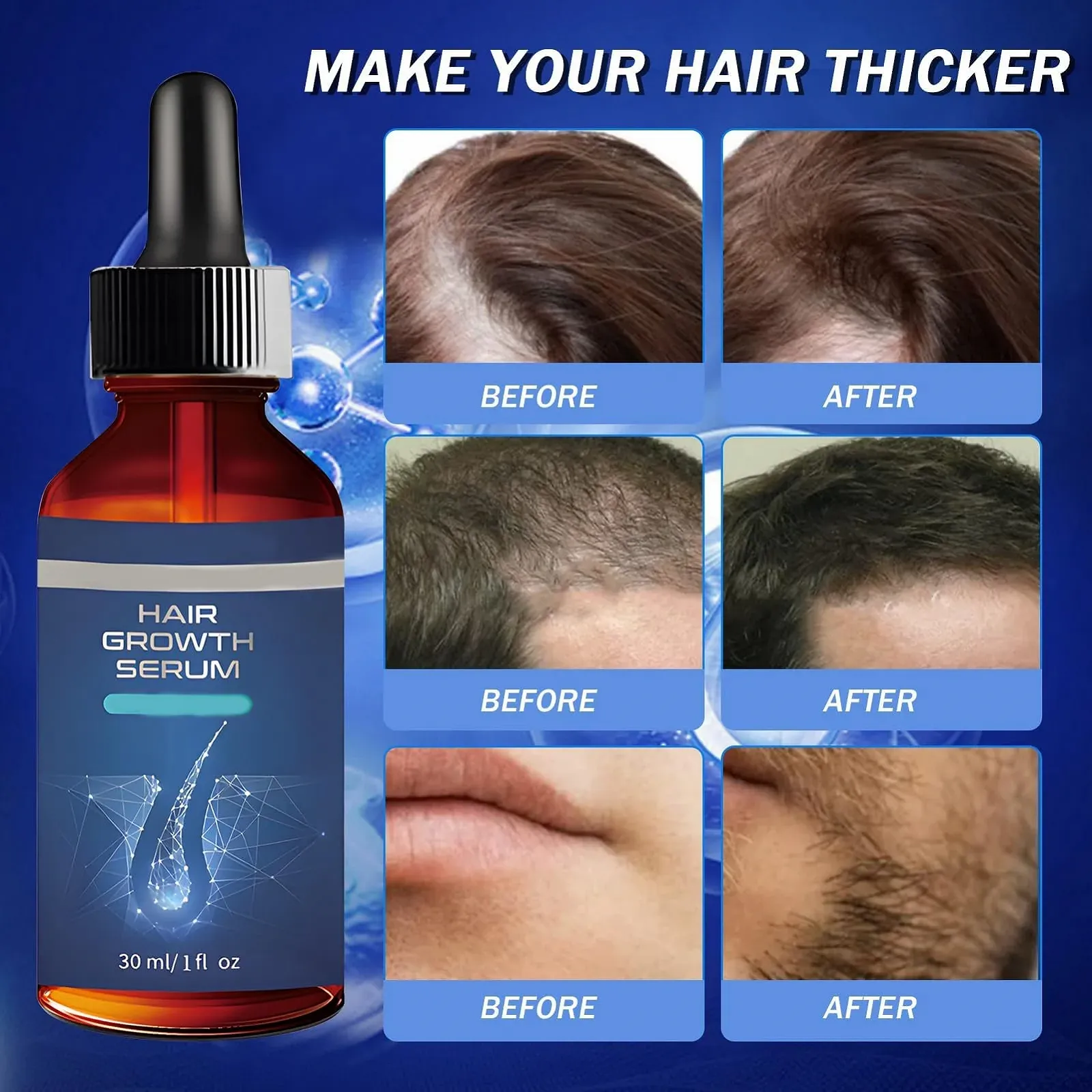 Сироватка для росту волосся з роликом 0,5 мм, сироватка проти випадіння волосся, фото №4 Сироватка для росту волосся з роликом 0,5 мм, сироватка проти випадіння волосся, фото №4