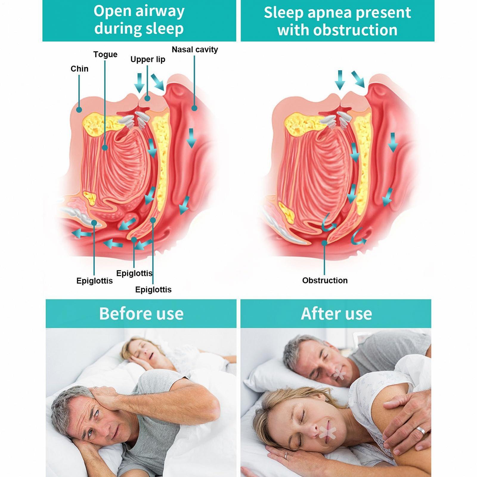 Смужки для сну STOPPER BOOT PAST-120, X-подібне рішення проти зморшок, тиха підтримка носа, фото №6 Смужки для сну STOPPER BOOT PAST-120, X-подібне рішення проти зморшок, тиха підтримка носа, фото №6