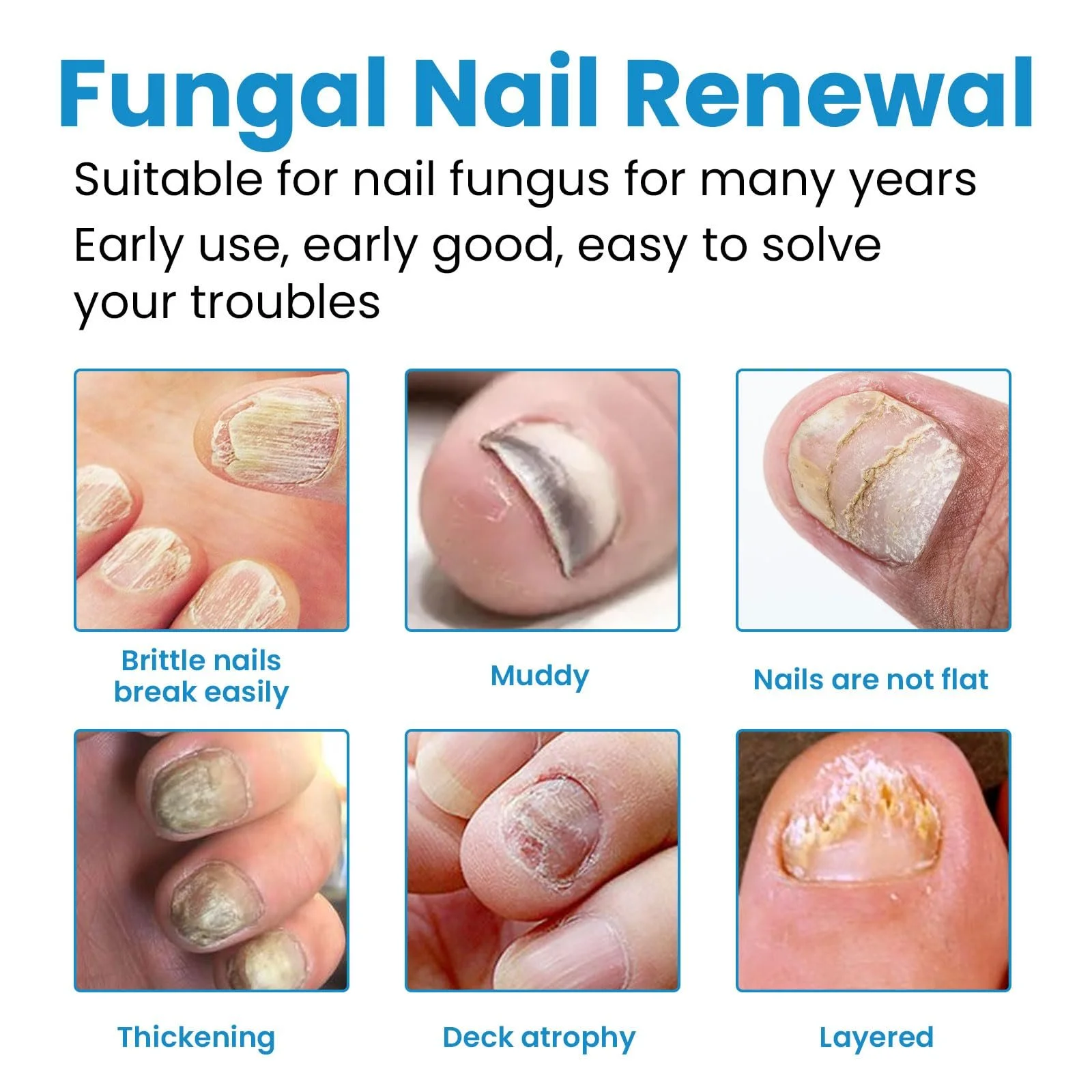 Спрей для догляду за ногами та нігтями захисний 100 мл, фото №4