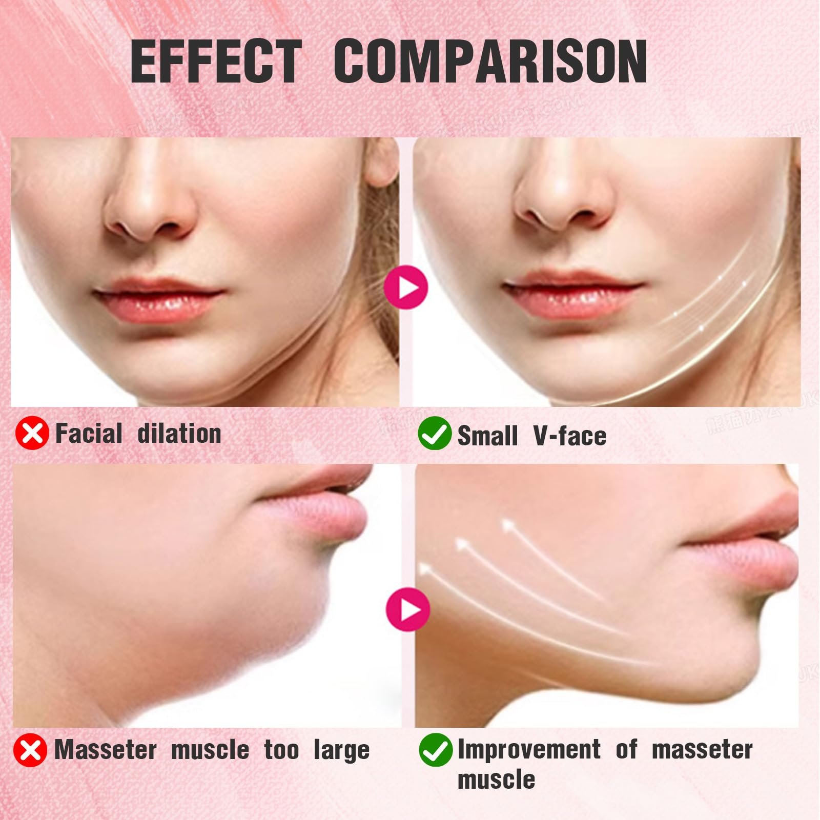 Повязка для подбородка XdealCozyxc с 2 гелевыми масками, дышащая V-образная маска для подтяжки лица для женщин и мужчин, фото №7