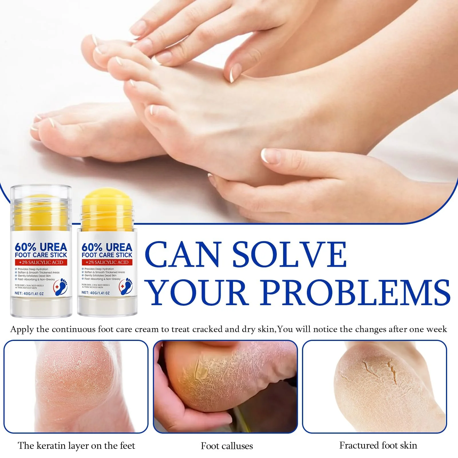 Крем для ног для очень сухой кожи с 60% мочевины 2 х 40 г и терка для стоп, фото №3