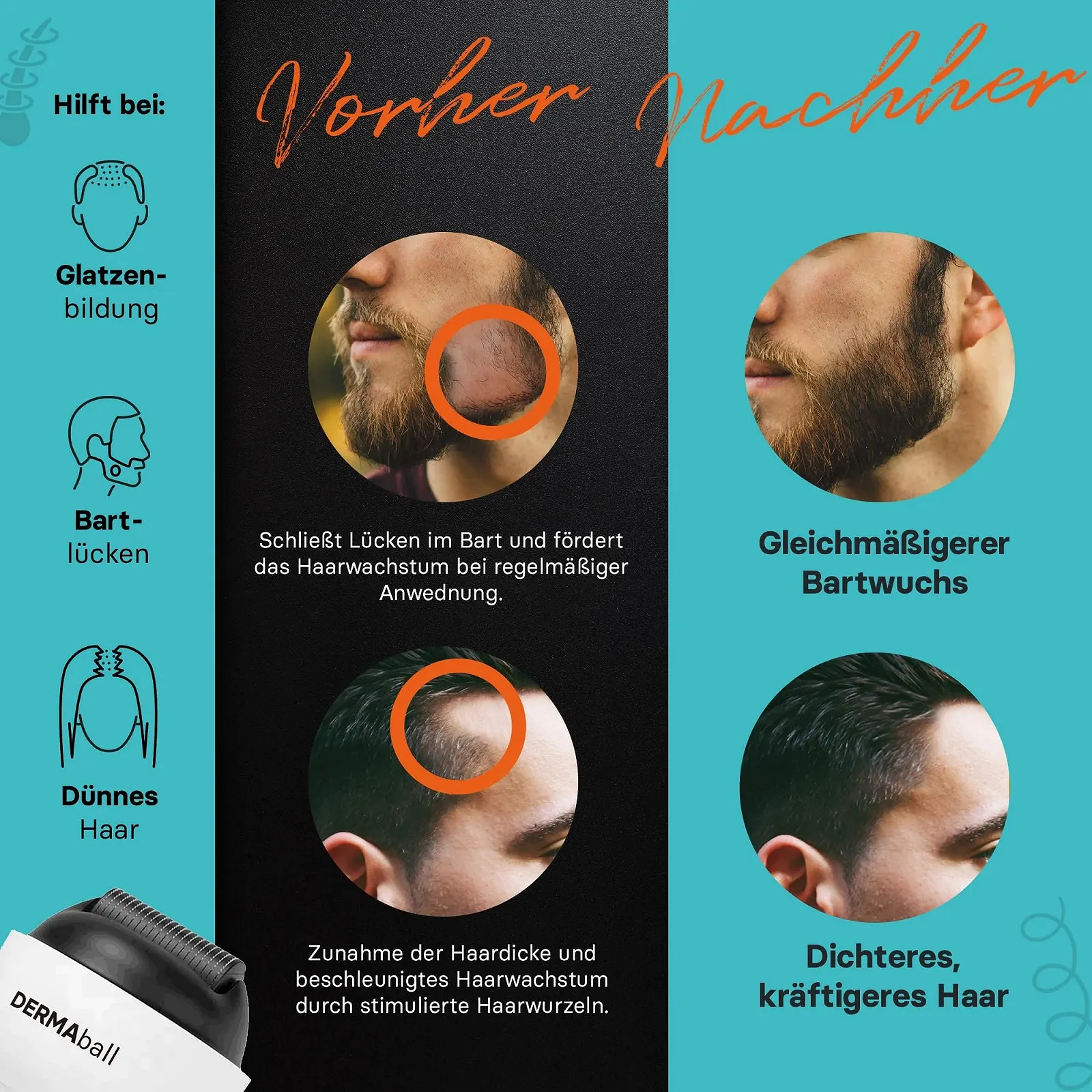 Дермаролер BS Luxry Premium, 1200 мікроголок з нержавіючої сталі, 0,5 мм, фото №3