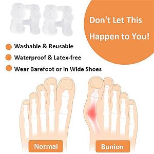 Роздільник для пальців ніг Силіконовий 2 пари Коректор великого пальця стопи synthetic.ua - Фото 1