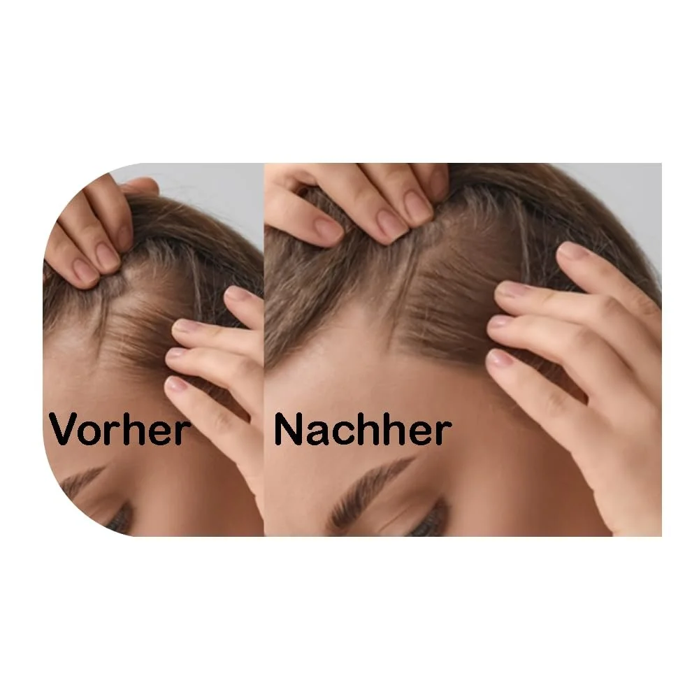 Дермаролер LEGERY 540 голок 0.5 мм, фото №3