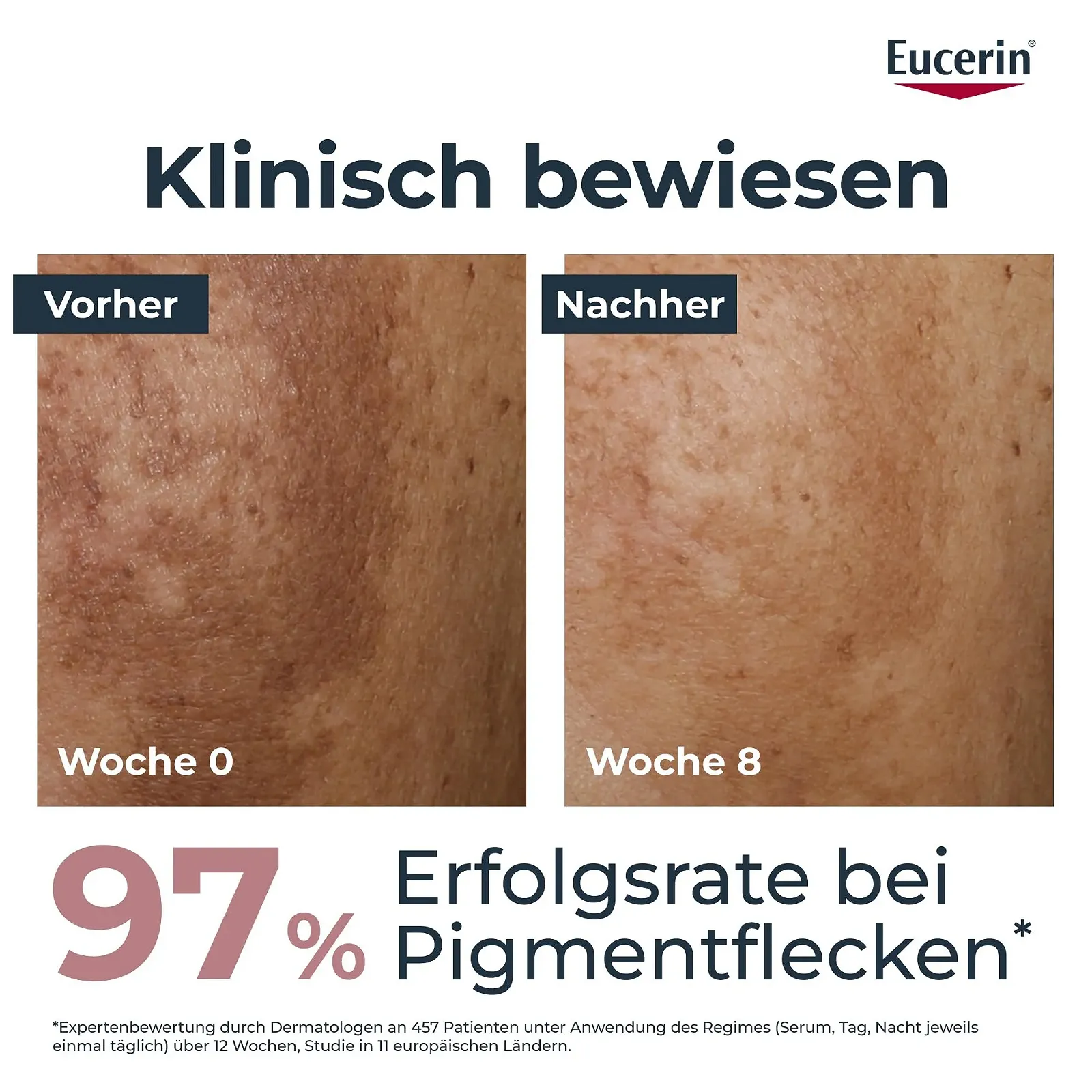 Денний крем Eucerin Anti-Pigment SPF 30 50 ml, фото №3 Денний крем Eucerin Anti-Pigment SPF 30 50 ml, фото №3