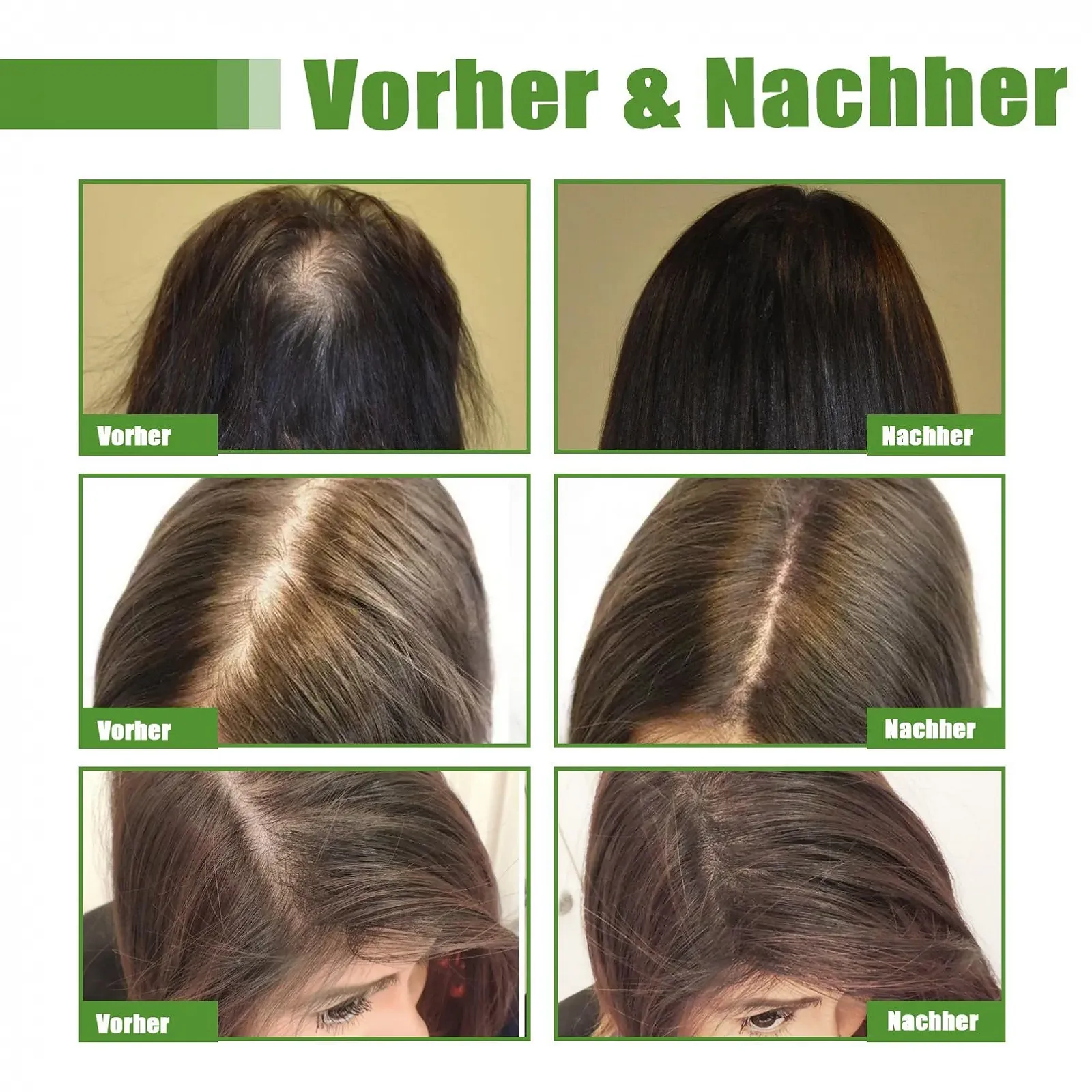 Масло Розмариновое для волос, 2 шт Эфирное масло розмарина для роста волос, Масло для роста волос, Масло для утолщения волос, Глубокое питание кожи головы, Укрепление, Уменьшает выпадение волос, фото №7 Масло Розмариновое для волос, 2 шт Эфирное масло розмарина для роста волос, Масло для роста волос, Масло для утолщения волос, Глубокое питание кожи головы, Укрепление, Уменьшает выпадение волос, фото №7