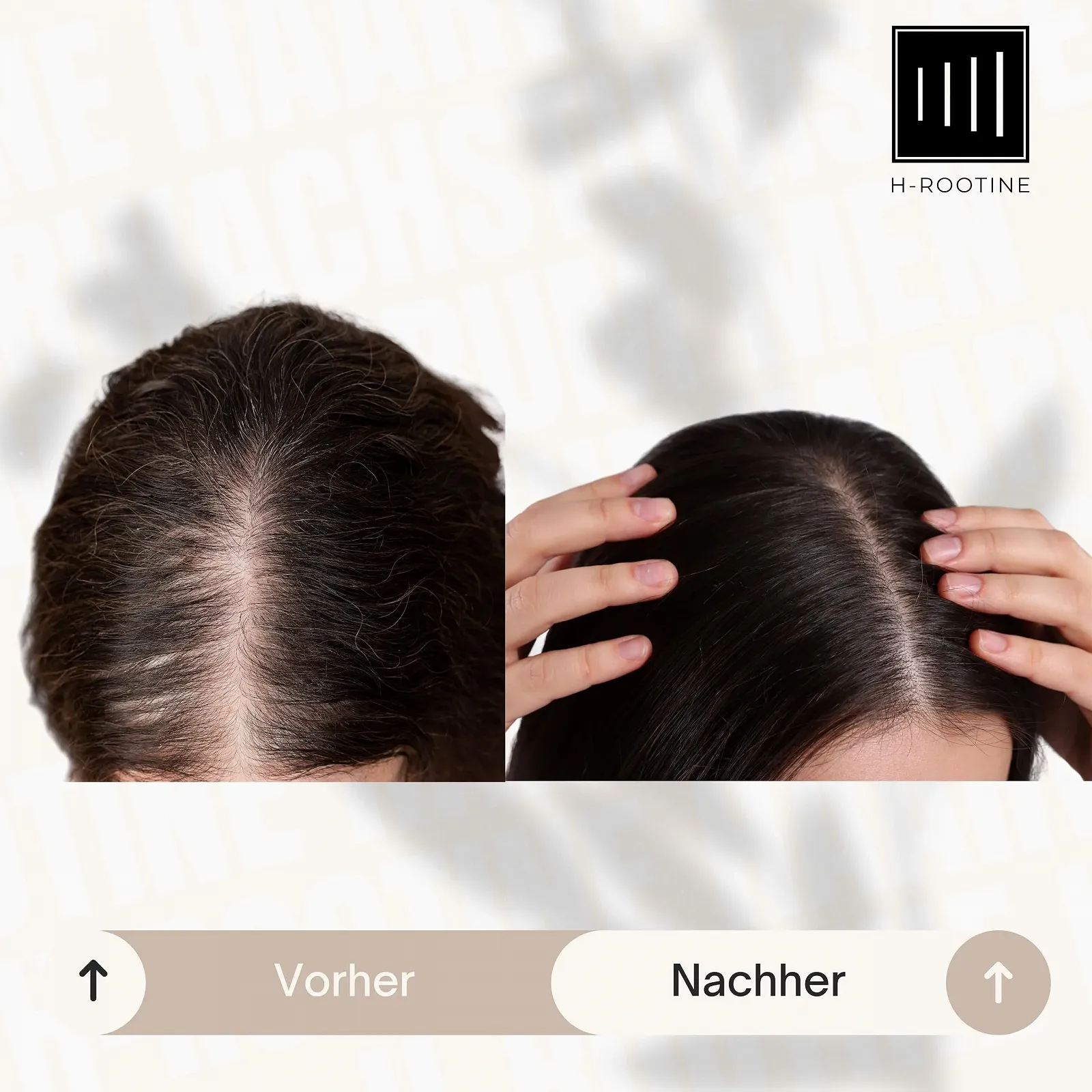 Сироватка для росту волосся H-ROOTINE для жінок 75 мл, фото №9
