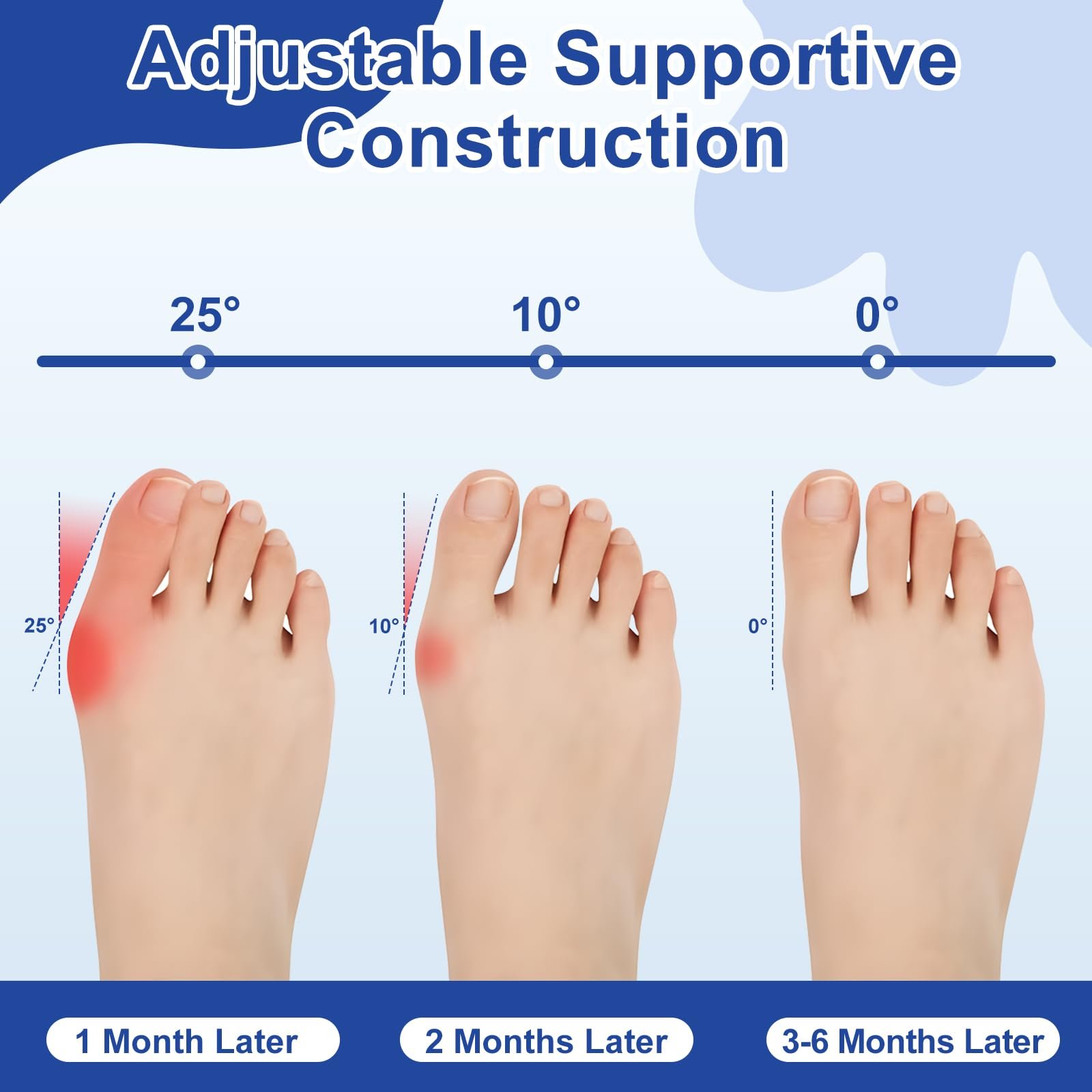 Регульований набір для корекції Hallux Valgus з шиною для великого пальця ноги, силіконовим роздільником для пальців ніг та тренувальною стрічкою, унісекс для лівої/правої ноги, фото №3