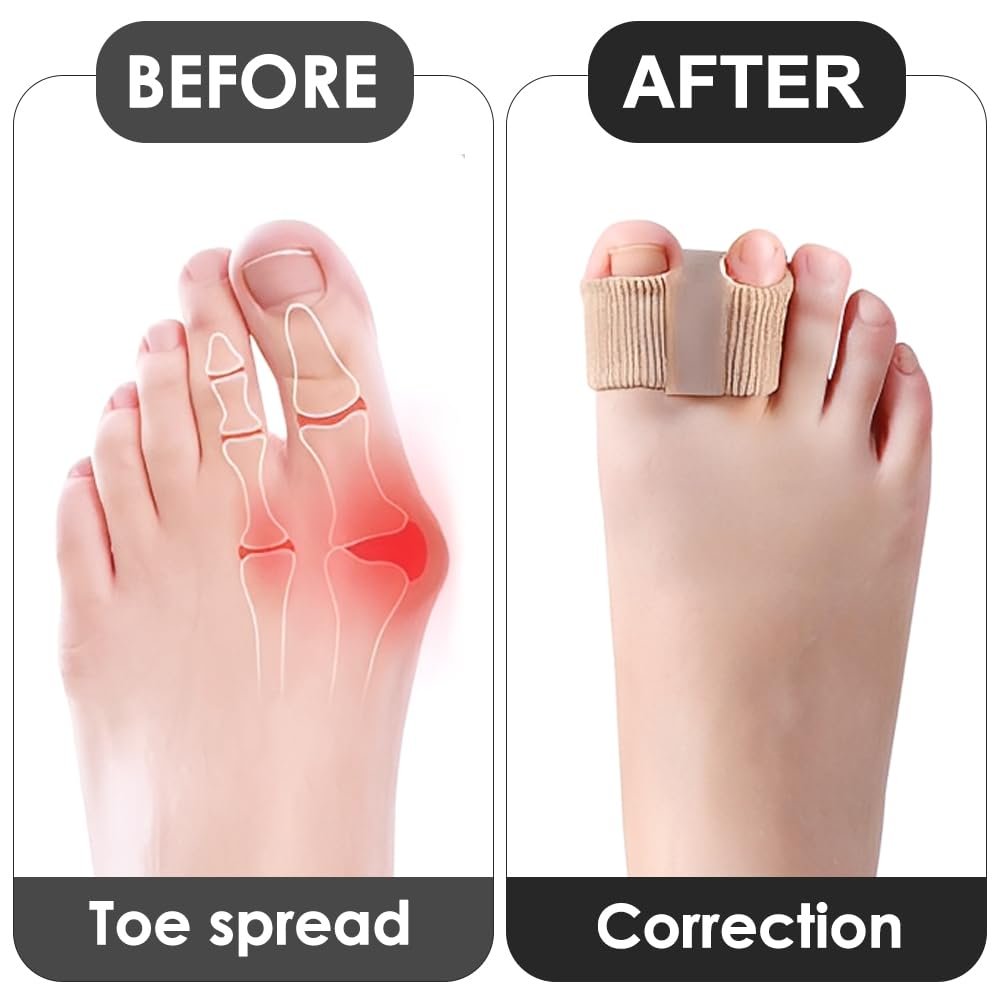 Роздільник для пальців ніг 8 шт Силікон Нейлон Зручний та дихаючий, фото №5