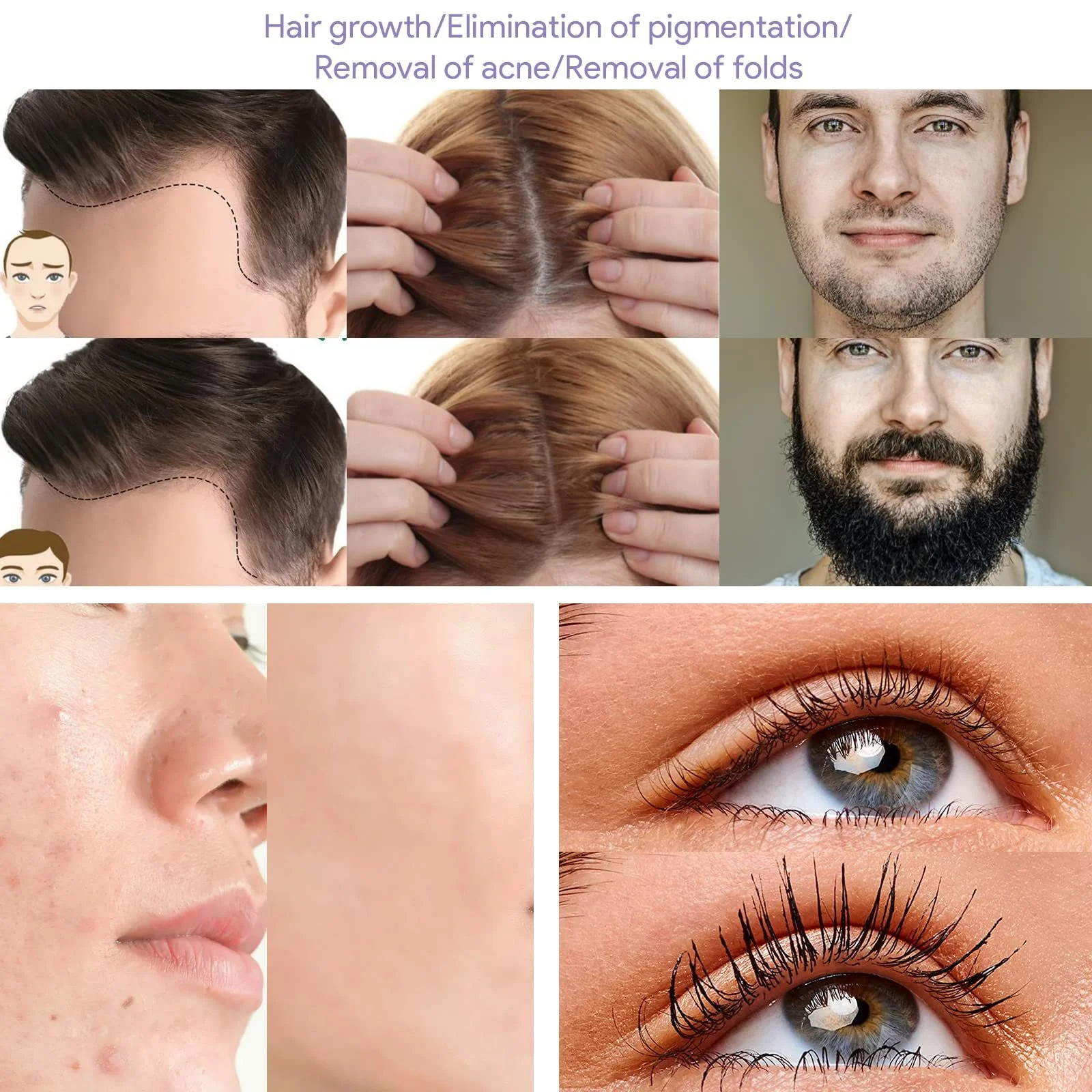 Набір з 2 Дерма ролерів для шкіри голови, фото №5