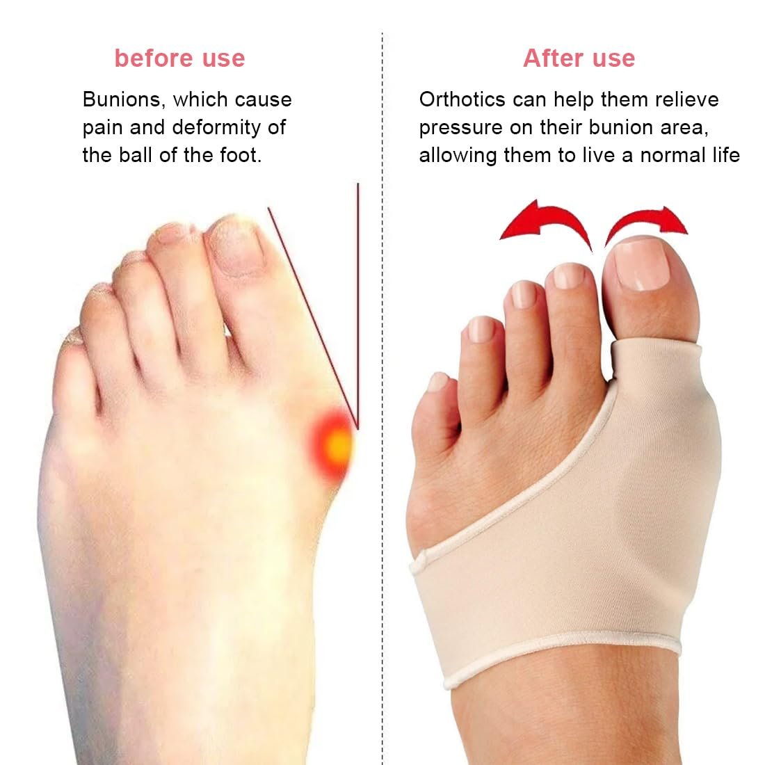 Коректор великого пальця стопи 1 пара, вальгусної деформації, фото №5